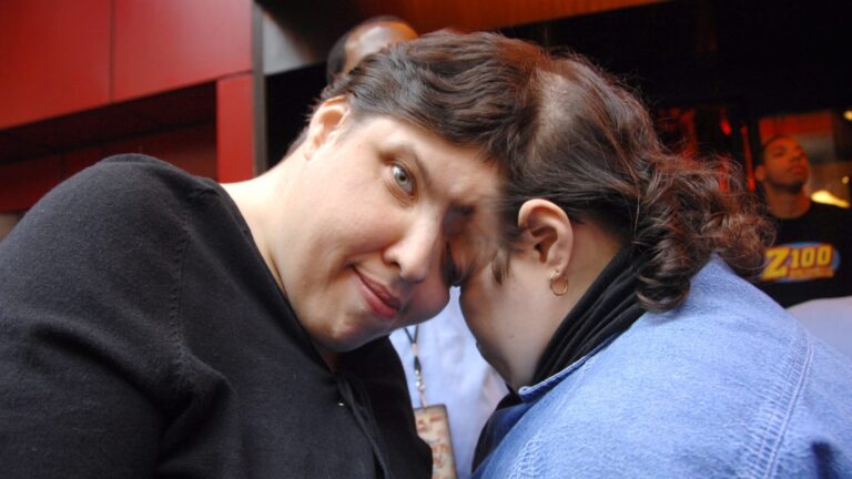 Report-Setting Conjoined Twins Lori and George Schappell Lifeless at 62